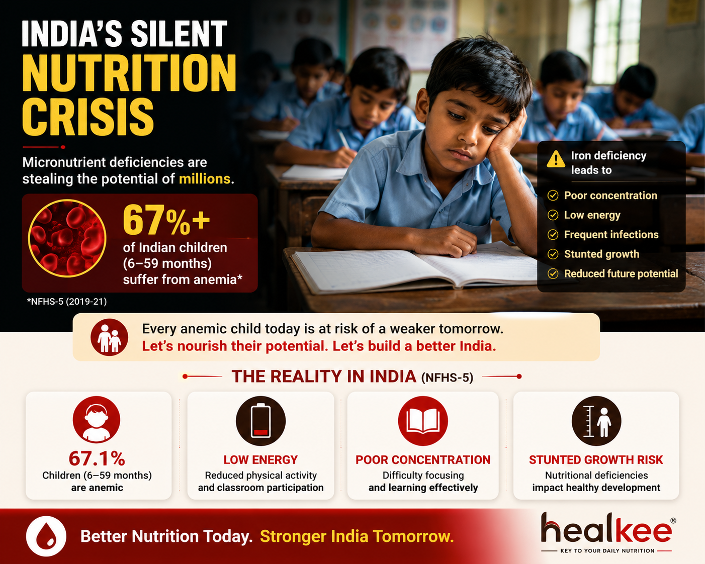 India's silent nutrition crisis - children affected by anemia